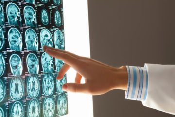 A doctor looks at x-rays for a head injury lawyer's client.