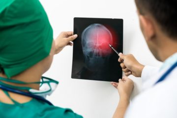 doctors examine the patient's skull xray