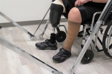 Amputee on a wheelchair waiting for his doctor for check-up.